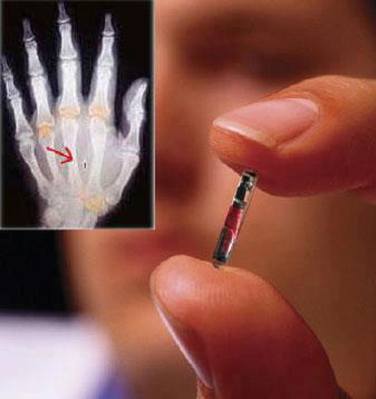 AI, Microchip Implant Imagine your President is Digitally hijacked